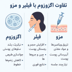 تفاوت اگزوزوم با فیلر و مزو