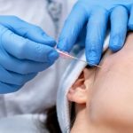 تفاوت عملکردی نخ های PLLA و PDO؛ چرا PLLA انتخاب اول برای لیفت های طولانی مدت است؟